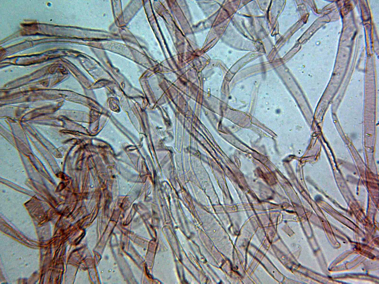 Microscopía de Lentinula edodes - 7 - Suprapellis x 400
